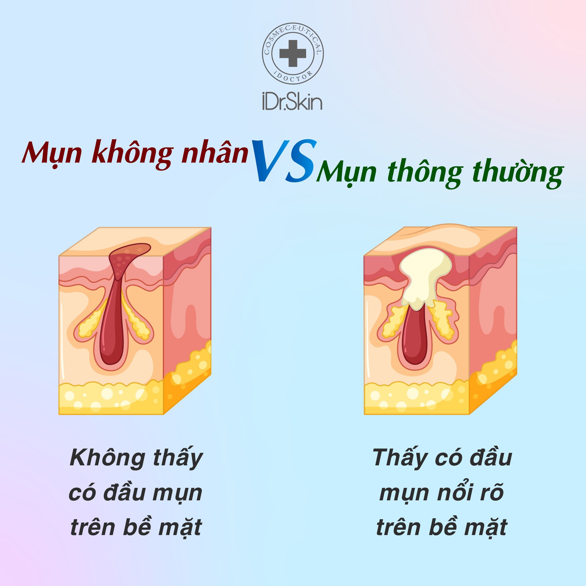 mun-khong-nhan-va-mun-thong-thuong