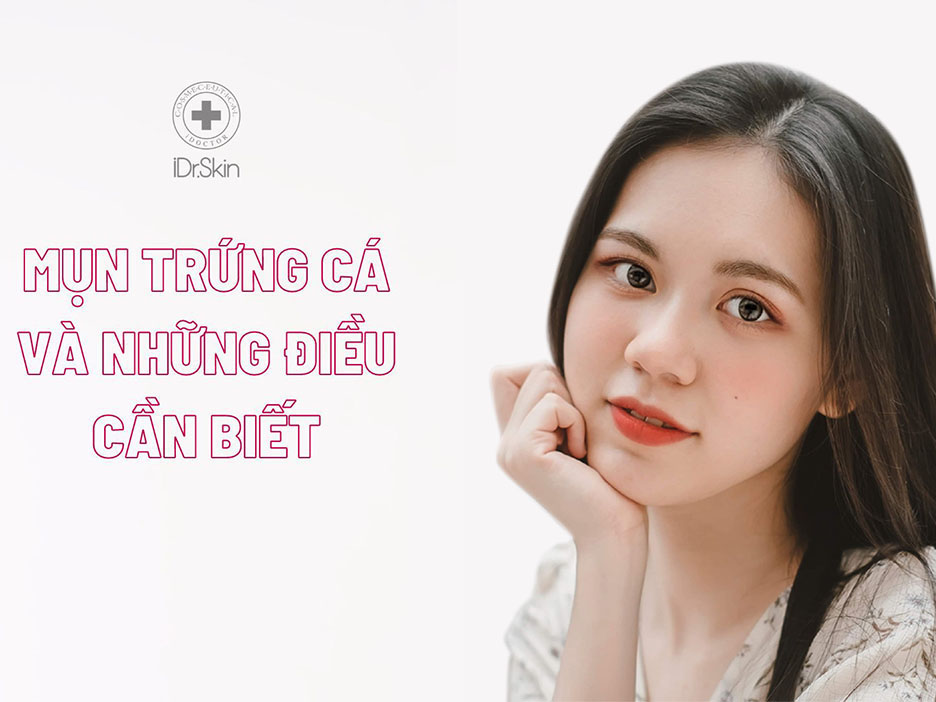 Mụn trứng cá là gì? Nguyên nhân và những điều cần lưu ý