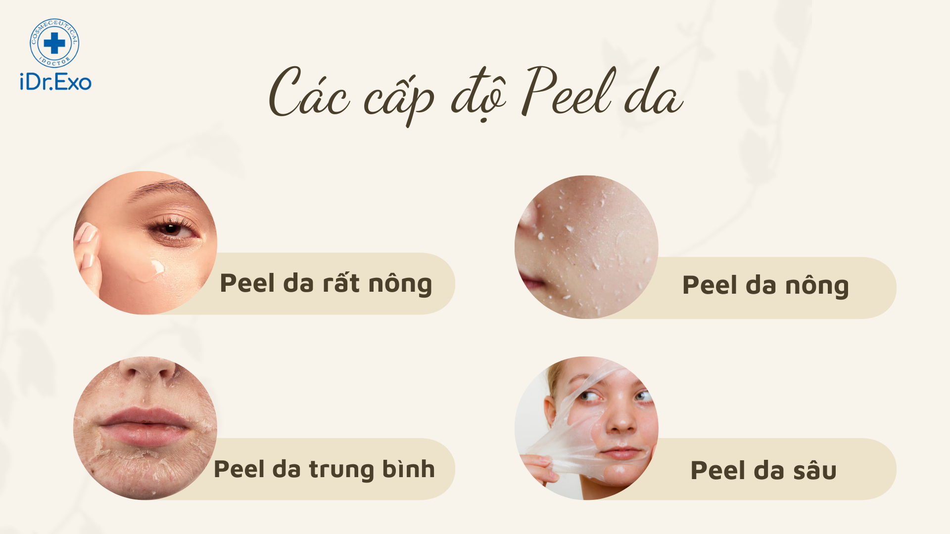 cap-do-peel-da